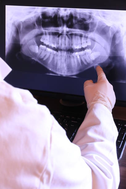 Best Root Canal Emergency Dentist  in Canton, OH