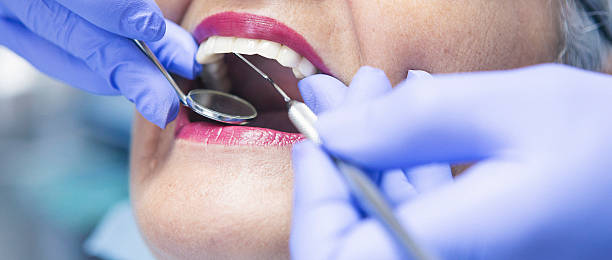 Best Dentist for Tooth Abscess  in Canton, OH