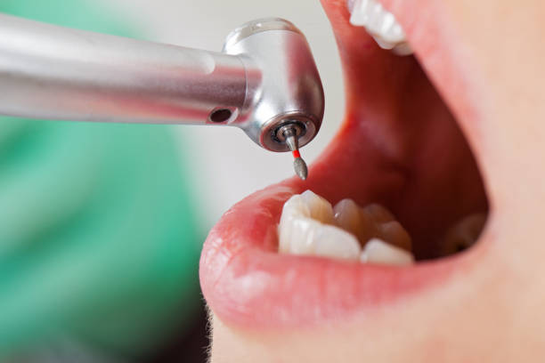Best Tooth Infection Emergency Dentist  in Canton, OH